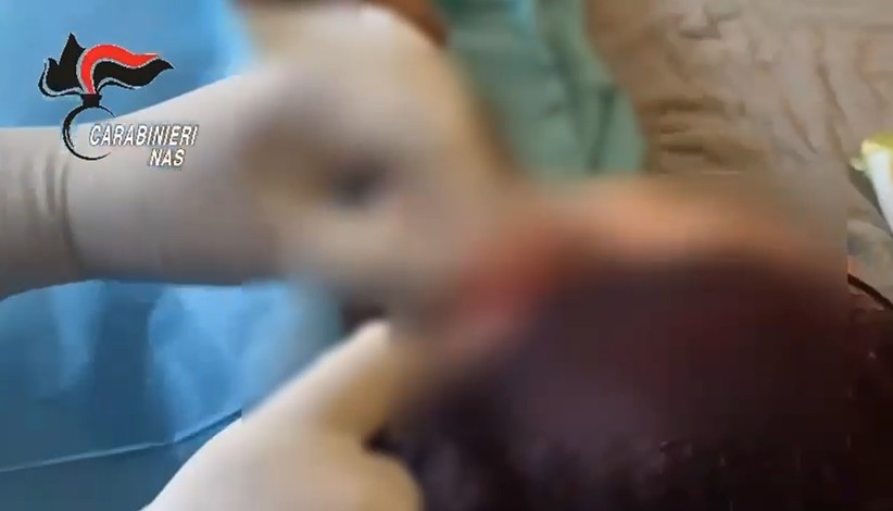 rome un medecin suspendu de ses fonctions surpris en train de pratiquer une intervention de chirurgie plastique