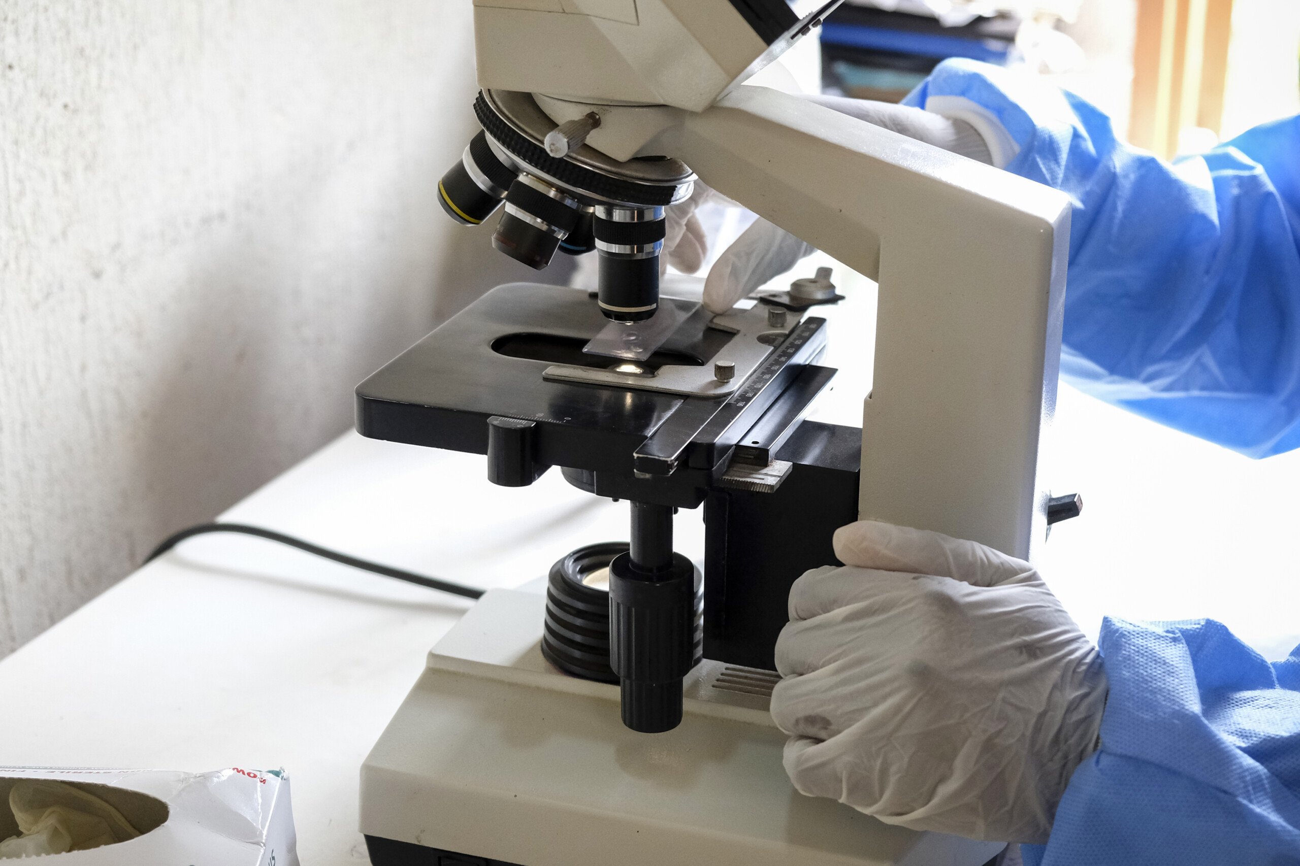 Ebola : résultat négatif au test effectué sur un patient rentré en Sardaigne en provenance du Congo 1 ebola resultat negatif au test effectue sur un patient rentre en sardaigne en provenance du congo scaled